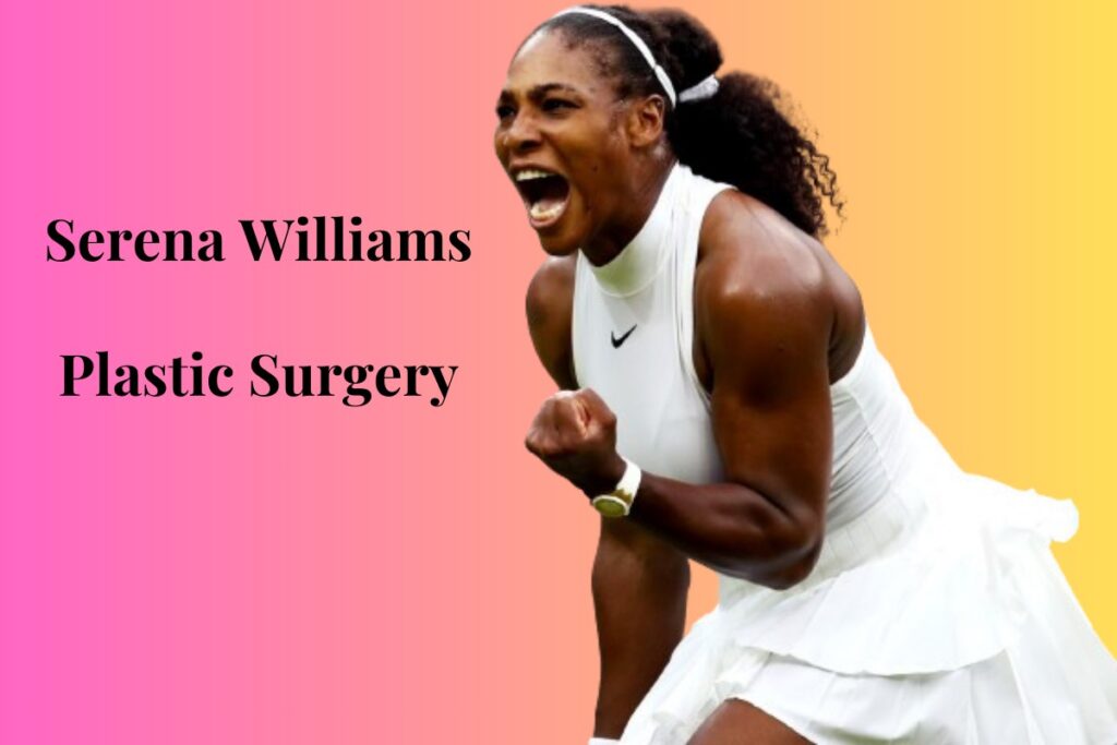 Serena Williams