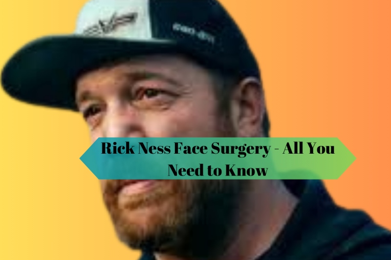 Rick Ness Face Surgery - All You Need to Know